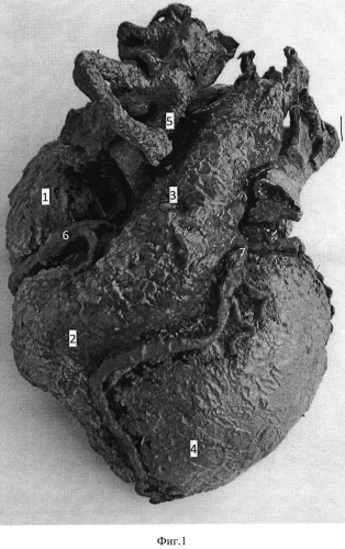 Способ изготовления сухого анатомического препарата сердца (патент 2547792)