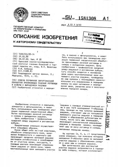 Способ первичной хирургической обработки проникающих ранений роговицы и склеры с выпадением радужки (патент 1581308)