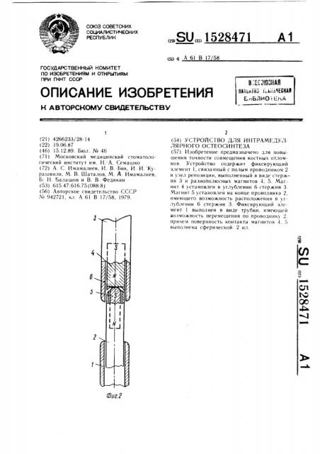 Устройство для интрамедуллярного остеосинтеза (патент 1528471)