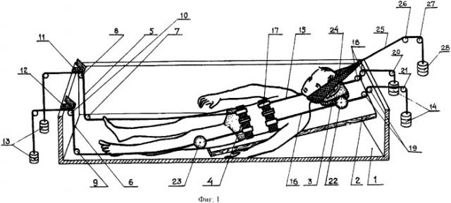 Установка для подводного полисегментарного вытяжения позвоночника (патент 2329023)