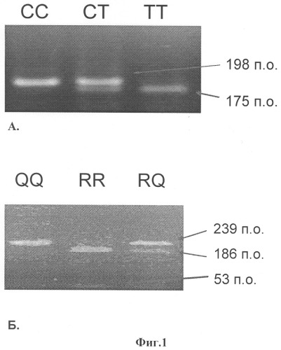 Применение днк-диагностики на наличие полиморфизма r353q в гене фактора vii свертывания крови для оценки предрасположенности к развитию привычного невынашивания беременности и способ оценки предрасположенности к этому заболеванию путем анализа сочетания полиморфизмов с677т гена mthfr и r353q гена фактора vii (патент 2330071)