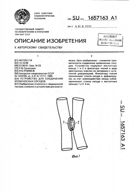 Устройство для соединения кровеносных сосудов (патент 1657163)