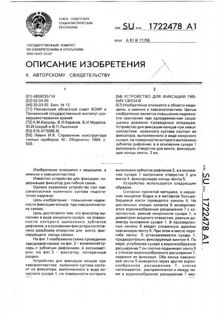 Устройство для фиксации гибких связей (патент 1722478)