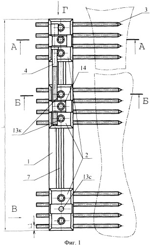 Аппарат внешней фиксации (патент 2352282)