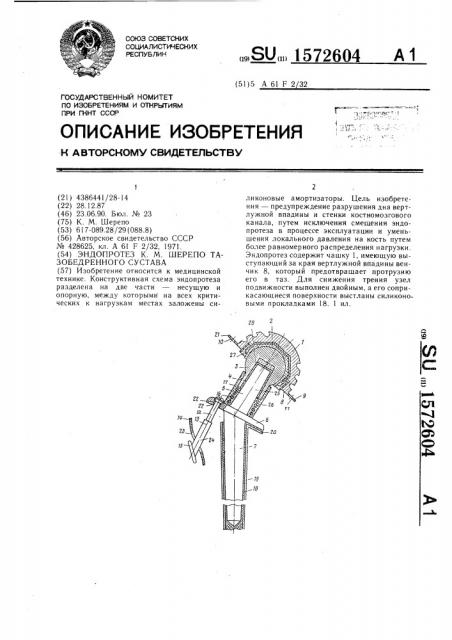 Эндопротез к.м.шерепо тазобедренного сустава (патент 1572604)