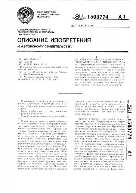 Способ лечения деформирующего артроза коленного сустава (патент 1503774)