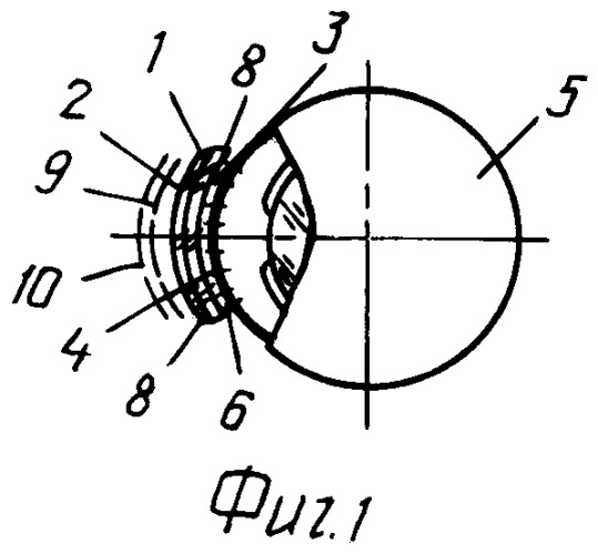 Глазная контактная линза (патент 2424543)