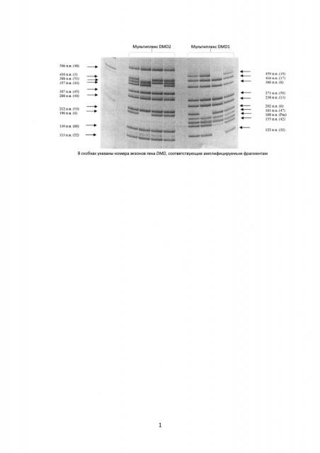 Набор последовательностей нуклеотидов для медицинской технологии детекции наиболее частых в россии делеций гена dmd методом мультиплексного пцр/пдаф анализа (патент 2625003)