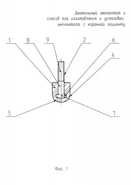 Дентальный имплантат и способ его изготовления (патент 2624169)