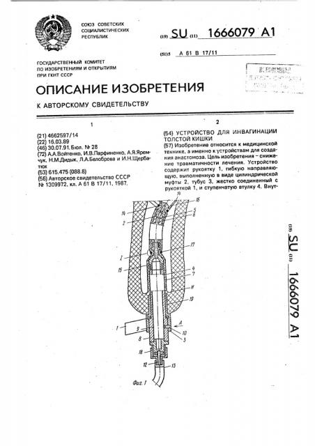 Устройство для инвагинации толстой кишки (патент 1666079)