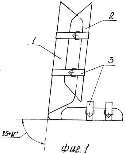 Голеностоп (патент 2384310)