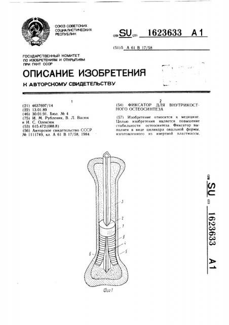 Фиксатор для внутрикостного остеосинтеза (патент 1623633)