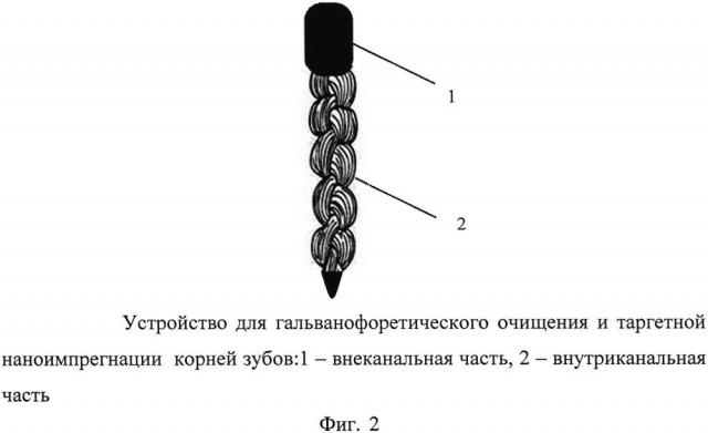 Устройство для гальванофоретического очищения и таргетной наноимпрегнации корней зубов (патент 2619874)