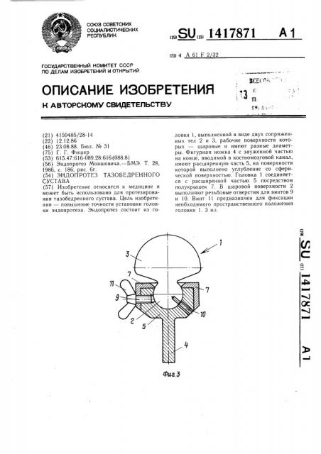 Эндопротез тазобедренного сустава (патент 1417871)