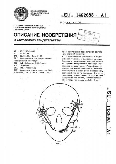 Устройство для лечения переломов верхней челюсти (патент 1482685)