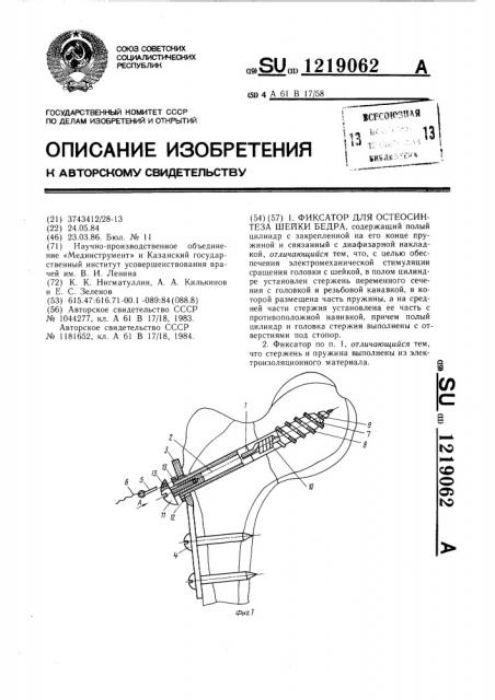 Фиксатор для остеосинтеза шейки бедра (патент 1219062)