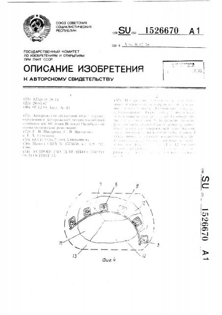 Устройство для накостного остеосинтеза (патент 1526670)