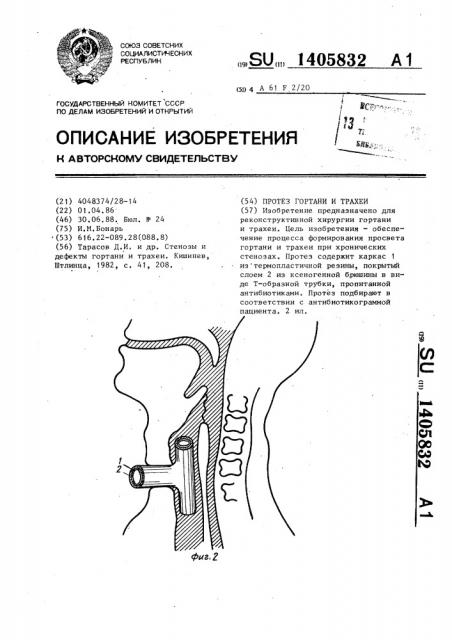 Протез гортани и трахеи (патент 1405832)