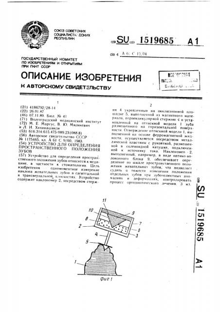 Устройство для определения пространственного положения зубов (патент 1519685)