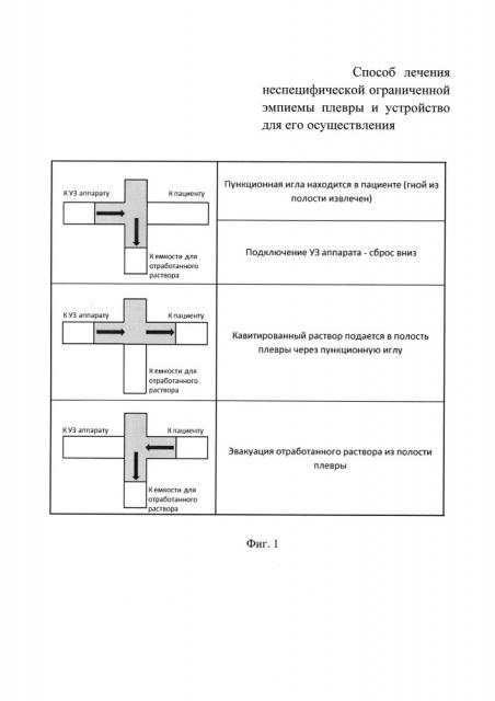 Способ лечения неспецифической ограниченной эмпиемы плевры и устройство для его осуществления (патент 2644290)