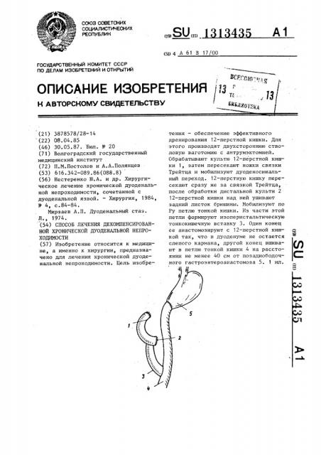 Способ лечения декомпенсированной хронической дуоденальной непроходимости (патент 1313435)