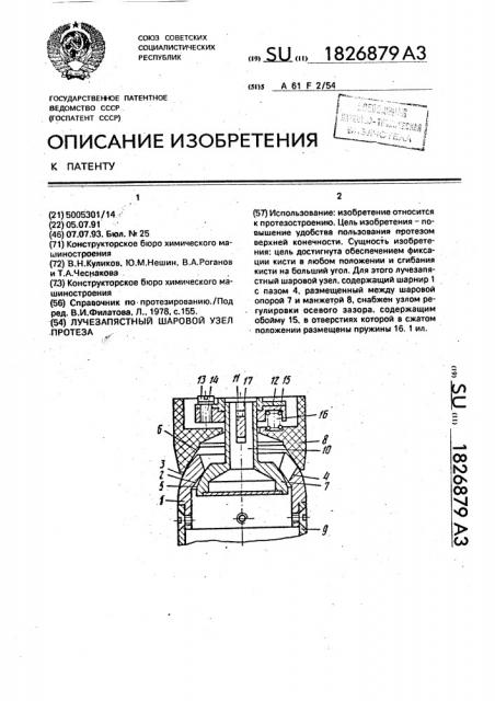 Лучезапястный шаровой узел протеза (патент 1826879)