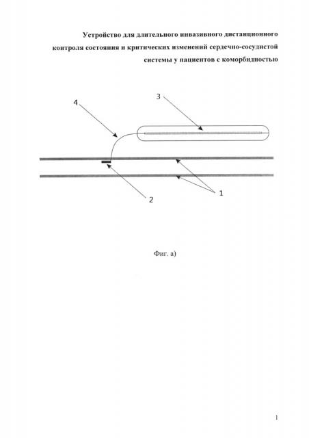 Устройство для длительного инвазивного дистанционного контроля состояния и критических изменений сердечно-сосудистой системы у пациентов с коморбидностью (патент 2613086)