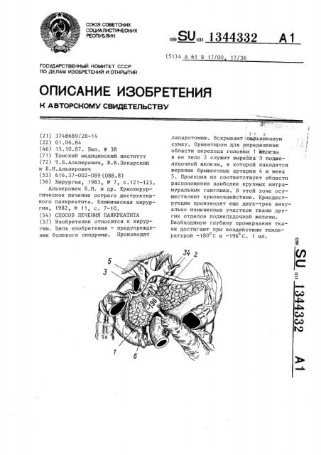 Способ лечения панкреатита (патент 1344332)