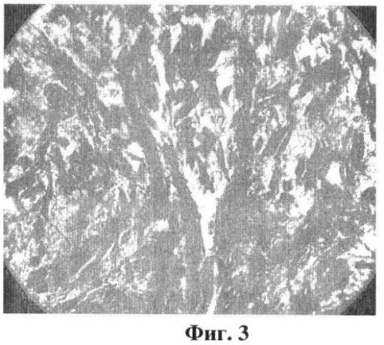 Способ нанесения биоактивного нано- и микроструктурированного кальцийфосфатного покрытия на имплантат из титана и его сплавов (патент 2444376)