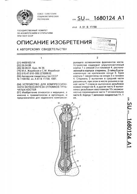 Устройство для компрессионного остеосинтеза отломков трубчатых костей (патент 1680124)