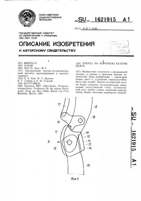 Протез на короткую культю бедра (патент 1621915)