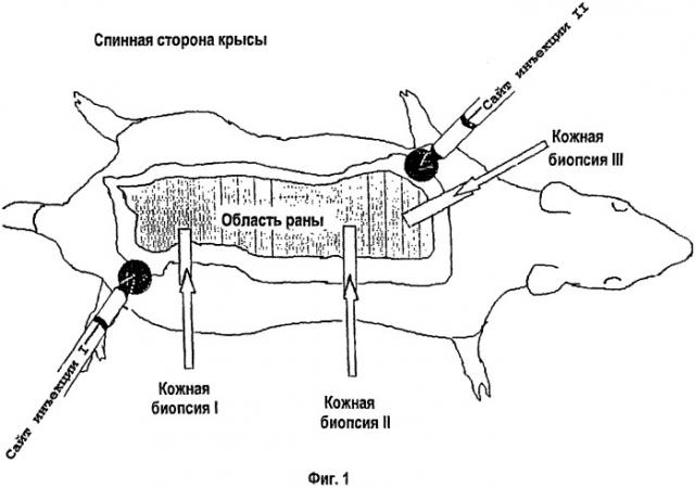 Усовершенствованное раневое покрытие для улучшения заживления ран (патент 2245722)
