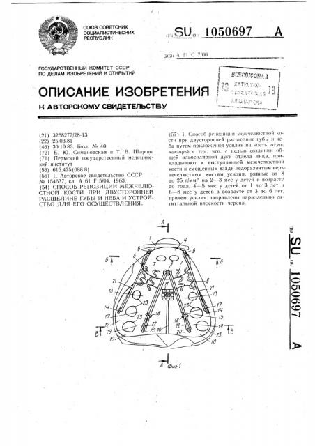 Способ репозиции межчелюстной кости при двусторонней расщелине губы и неба и устройство для его осуществления (патент 1050697)