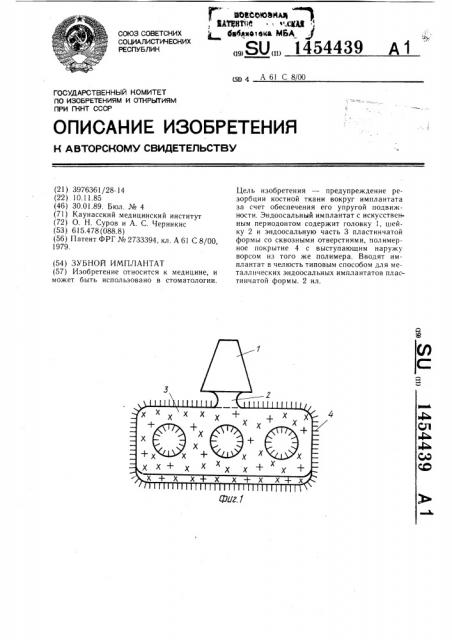 Зубной имплантат (патент 1454439)