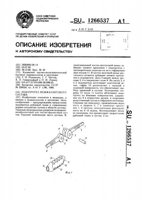 Эндопротез межфалангового сустава (патент 1266537)