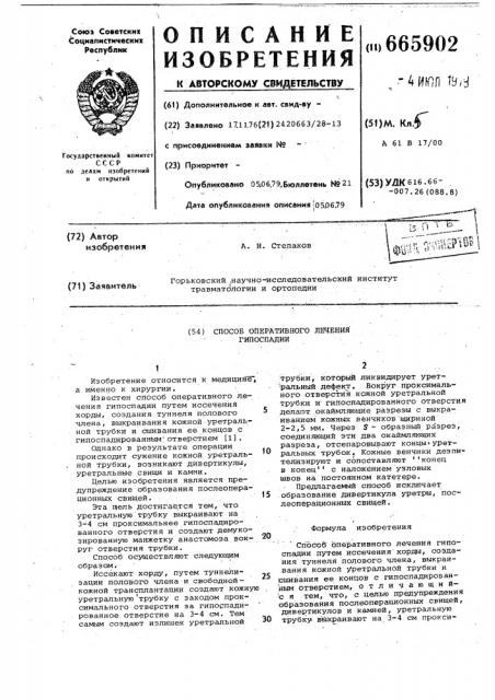 Способ оперативного лечения гипоспадии (патент 665902)