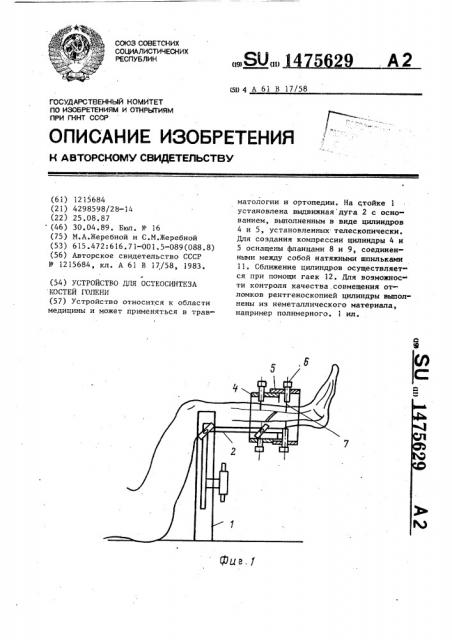 Устройство для остеосинтеза костей голени (патент 1475629)