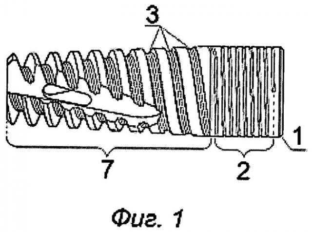 Дентальный внутрикостный имплантат и абатмент для него (патент 2441621)