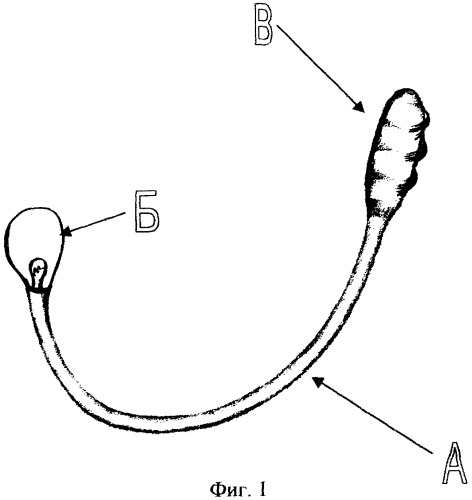 Инструмент для поиска культи прямой кишки в полости малого таза при реконструктивных операциях на толстой кишке (патент 2302812)