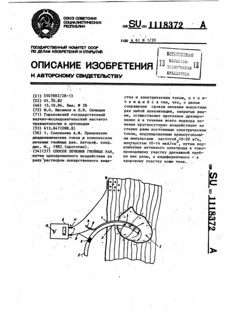 Способ лечения гнойных ран (патент 1118372)