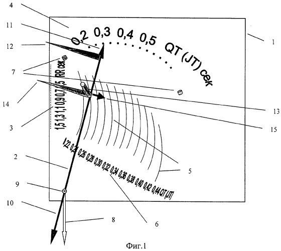 Устройство для обработки интервалов электрокардиограмм (патент 2261040)