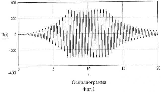 Способ измерения артериального давления (патент 2441581)