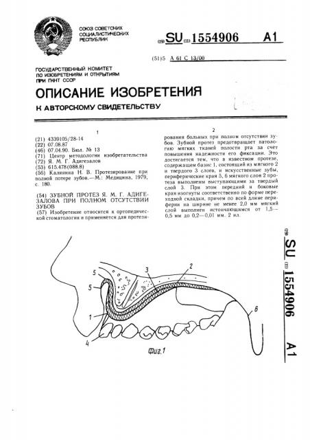 Зубной протез я.м.г.адигезалова при полном отсутствии зубов (патент 1554906)