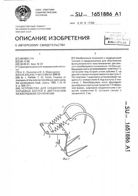 Устройство для соединения берцовых костей в дистальном межберцовом сочленении (патент 1651886)