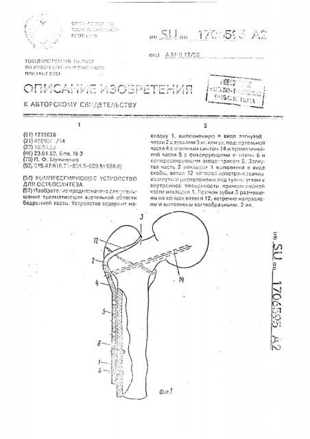 Компрессирующее устройство для остеосинтеза (патент 1706595)