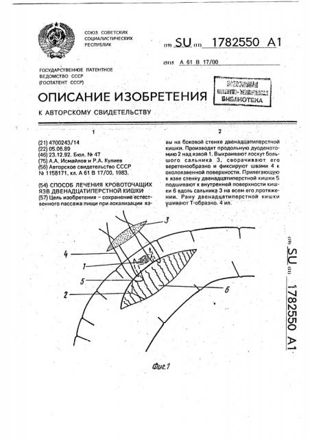 Способ лечения кровоточащих язв двенадцатиперстной кишки (патент 1782550)