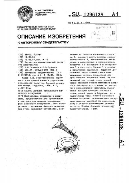 Способ лечения врожденного кишечного недержания (патент 1296128)