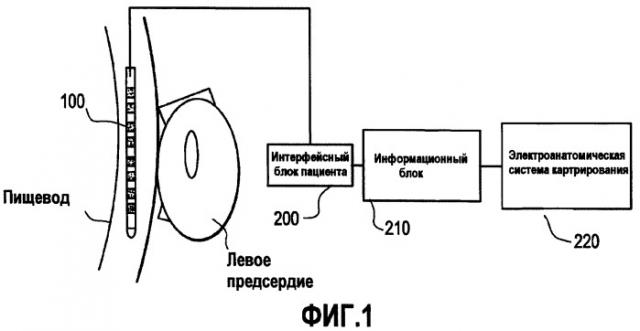 Катетер для картрирования пищевода (патент 2417732)