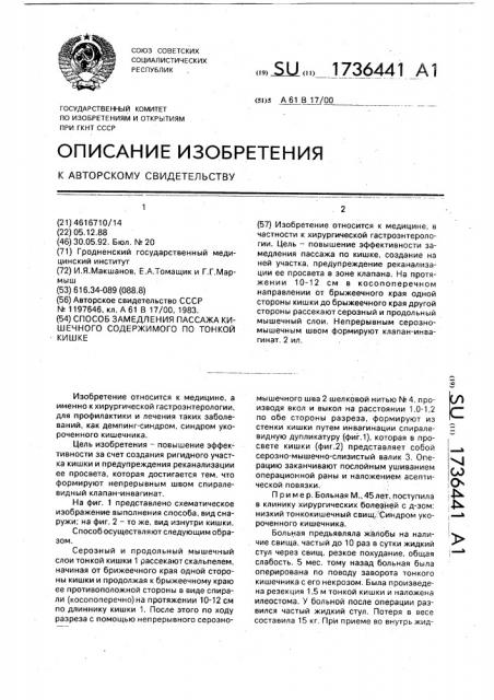Способ замедления пассажа кишечного содержимого по тонкой кишке (патент 1736441)