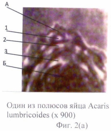 Способ прижизненной дифференциальной диагностики ascaris lumbricoides и ascaris suum по микроструктуре яиц (патент 2464561)